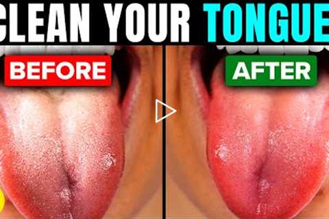 Your Tongue Is Probably Filthy, Here's How To Effectively Clean It