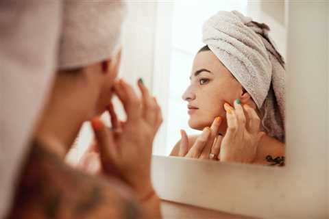 Pimples Not Clearing Up? You Might Be Dealing With Fungal Acne