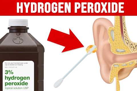 9 Unexpected Benefits of Hydrogen Peroxide