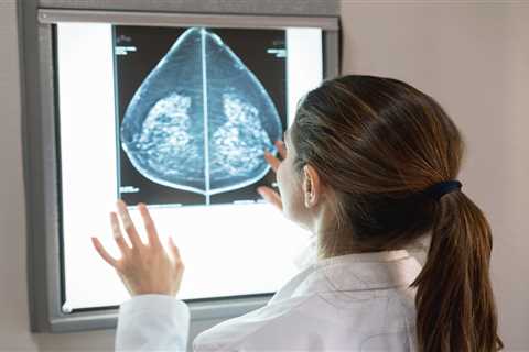 Half of patients with suspected breast cancer wait longer than two week target to see a specialist