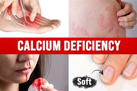 Best Home Test for a CALCIUM DEFICIENCY