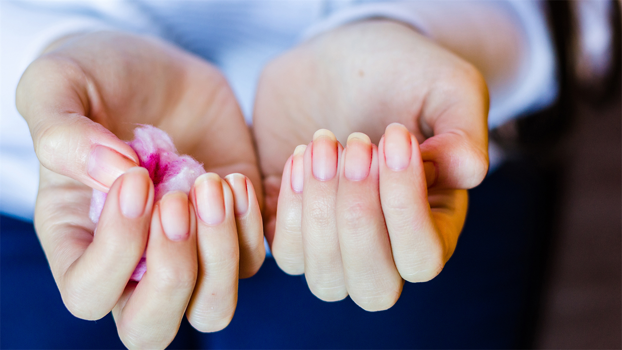 What Causes Dents in Fingernails and How Do I Get Rid of Them?