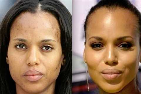 How to reduce skin discoloration | Fashionable Beauty