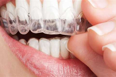 When does invisalign not fit?