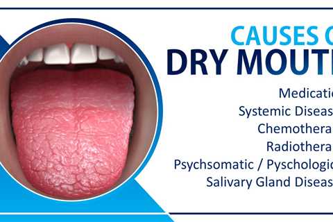 How to Prevent Dry Mouth