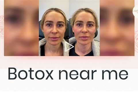 Botox injections near me