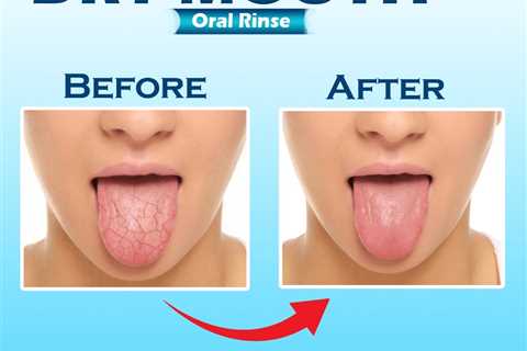 cure dry mouth during pregnancy