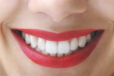 Do Receding Gums Grow Back? - Freedom Is Important