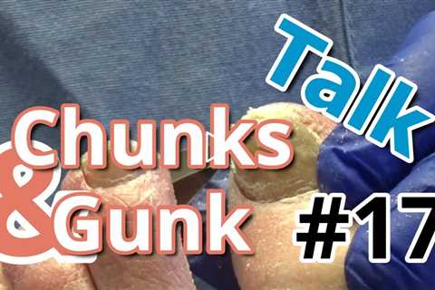 Chunks and Gunk #17 - Conversation with Dr Nail Nipper