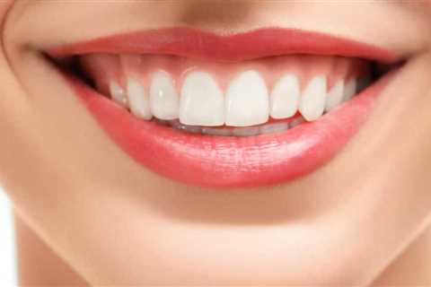 Nature's Smile A Natural Treatment for Receding Gums - Poll Clash