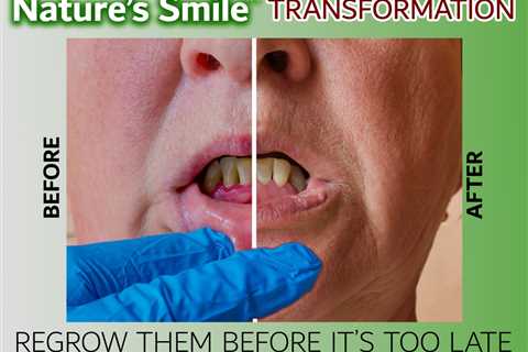 Natures Smile Regrow Gums