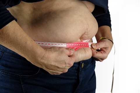 Weight Loss Surgery Has a Big Effect on Marriage