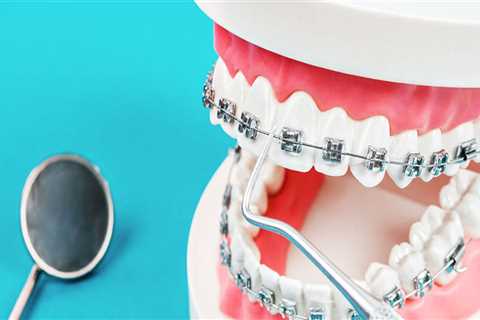 Are dental braces considered cosmetic?