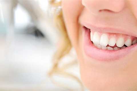Home | will receding gums heal