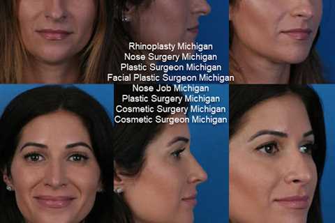 Lakeshore Facial Plastic Surgery