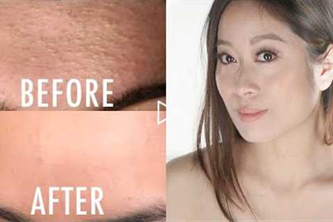 How To Get Rid of Whiteheads/Closed Comedones | Vivienne Fung