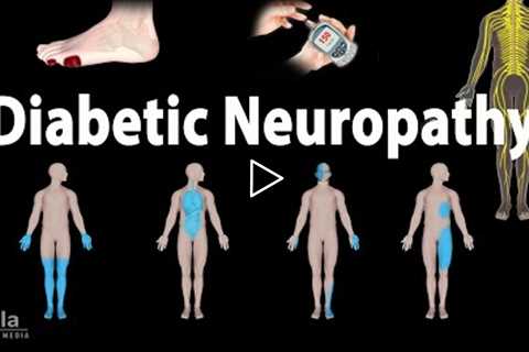 Diabetic Neuropathy, Animation