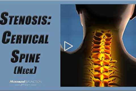 Cervical Spine Stenosis | Best Exercises to Decrease Pain (and Other Symptoms)