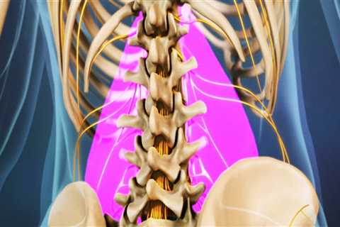 Where back pain comes from?