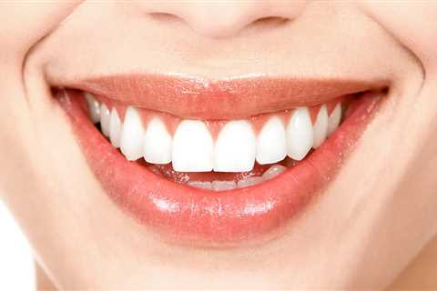 Nature’s Smile Reviews - A Natural solution for Gum Regrowth DocPatient Blog