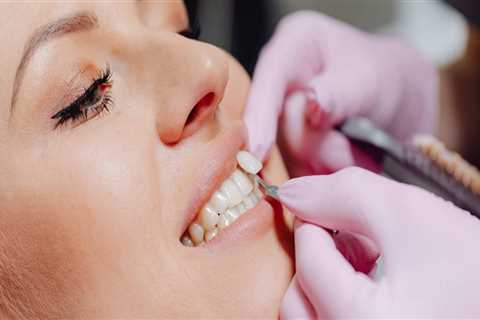 Cosmetic Dentistry In Highland: What You Need To Know