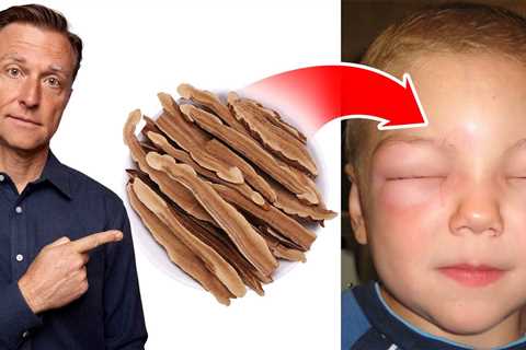 Natural Remedy for Anaphylactic Shock