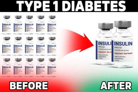 The MOST Important Tip to Lower Insulin for TYPE 1 DIABETES: (Must Watch)