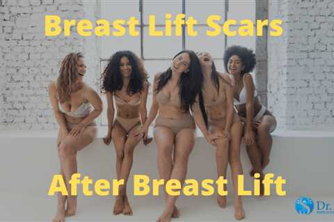 Do Scars Go Away After Breast Reduction?