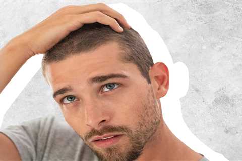 Which Hair Regrowth Works Best For Men?