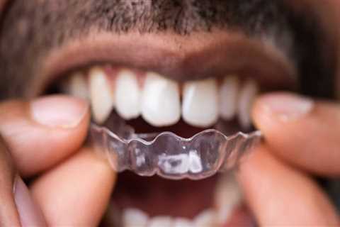 Do aligners weaken enamel?