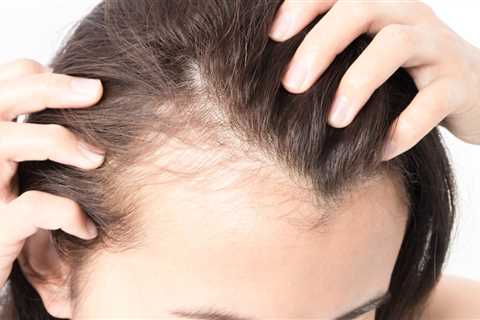 Medical Mystery: Hair Thinning Chronic Pain and Inflammation  What Caused This TikTokers Symptoms?