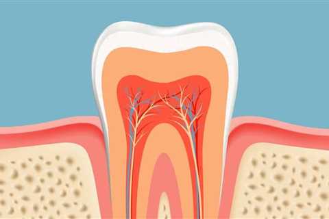 How To Treat Exposed Tooth Root? - Receding Gums Treatment