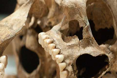How did ancient humans care for their teeth?