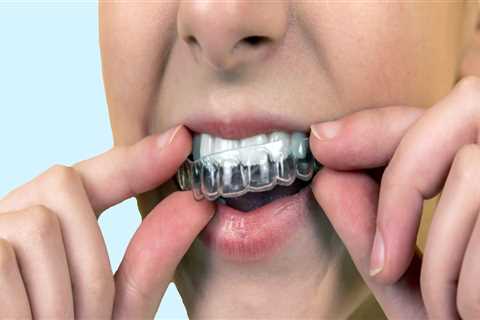 How Much Does Invisalign Cost? A Comprehensive Guide to Understanding the Cost of Orthodontic..