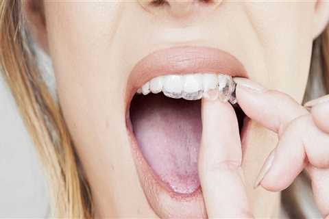 What Qualifications Do Invisalign Dentists Need to Have?