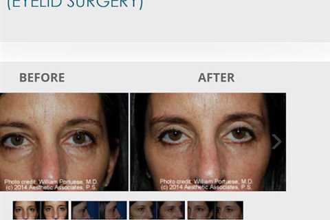 The Seattle Eyelid & Blepharoplasty Center