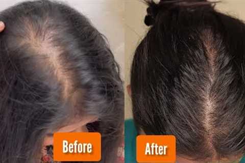 Best AYURVEDIC HERBS For Hair REGROWTH | Hair Growth Herbs | Shinny Roops