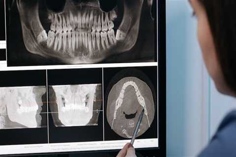 Significance Of Selecting The Appropriate Dentist For Your Dental X-ray Checkups In Waco, TX