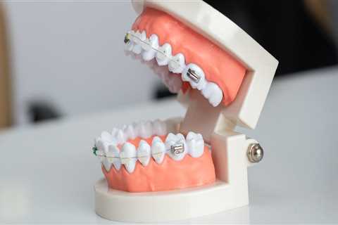 The Advantages And Disadvantages Of Using Laser Dentistry For Orthodontic Treatment In Georgetown