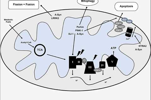 Intermittent Fasting and Brain Health Research 2023