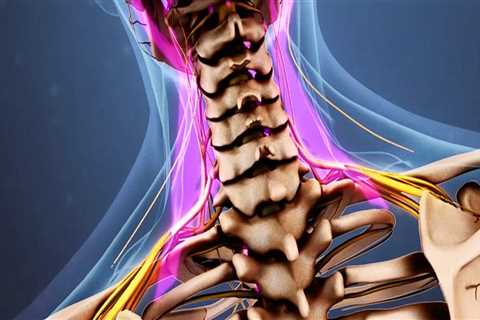 How long does it take for neck pain to go away?