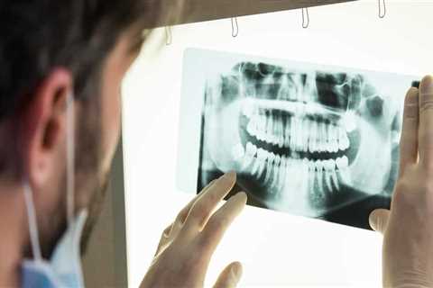 Are dental x-rays really necessary and why?