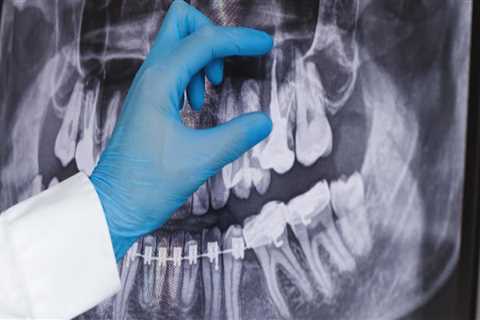 Which dental x ray gives the least amount of radiation?