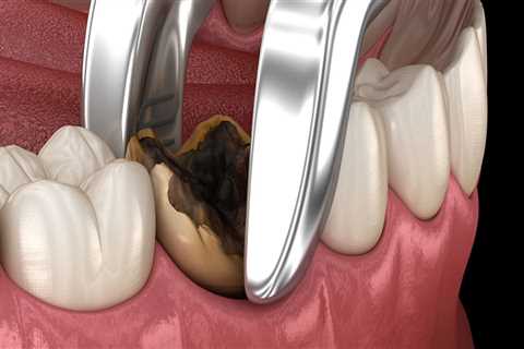 What is the most complicated dental procedure?