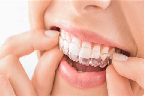 5 Tips to Choose the Best Invisalign Orthodontist