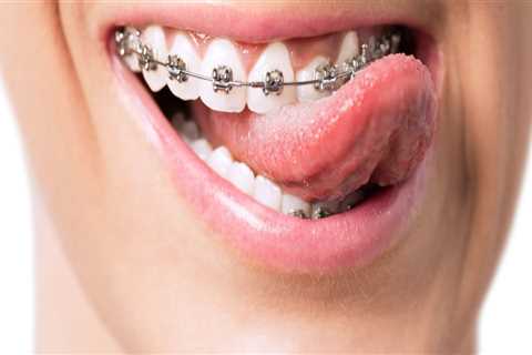 What is orthodontia used for?