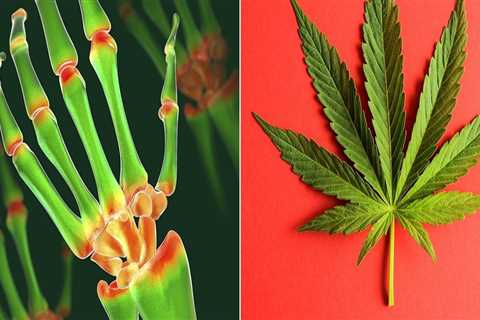 How to Safely Use THC for Arthritis Pain Relief