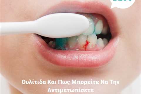 Standard post published to Smalto Dental Clinic at April 17, 2023 10:00