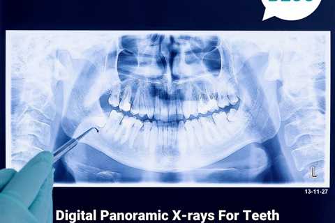 Standard post published to Smalto Dental Clinic at April 12, 2023 10:00