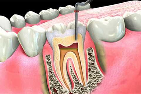 Standard post published to Symeou Dental Center at March 19, 2023 10:00